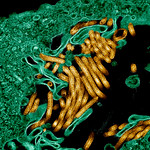 Flickr-micrograph of Ebola virus particles 5