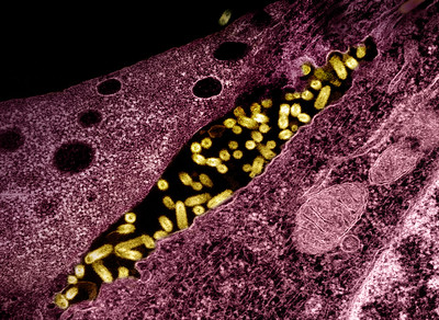 Flickr-micrograph showing vesicular stomatitis virus (VSV) 1