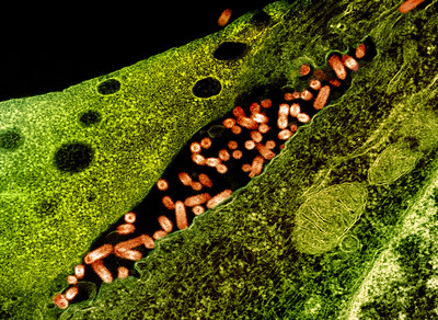 Flickr-micrograph showing vesicular stomatitis virus (VSV) 2