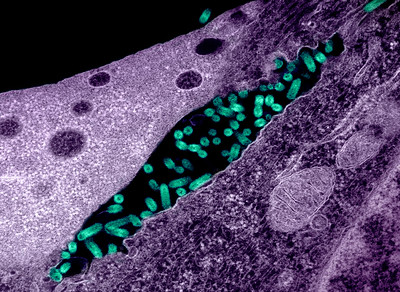 Flickr-micrograph showing vesicular stomatitis virus (VSV) 3