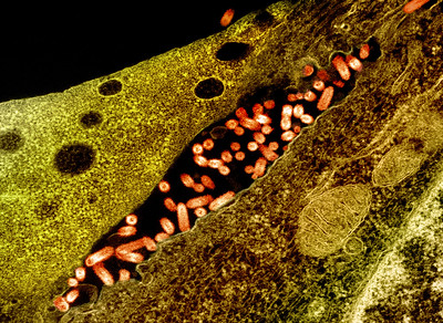 Flickr-micrograph showing vesicular stomatitis virus (VSV) 4
